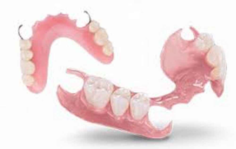 How Long Do Acrylic Dentures Last?
