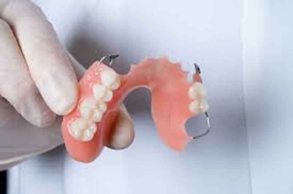 How Long Do Acrylic Dentures Last?